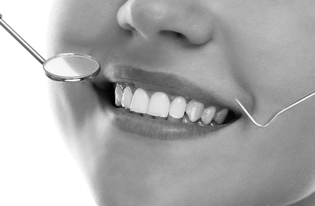 5 Benefits of Dental Insurance